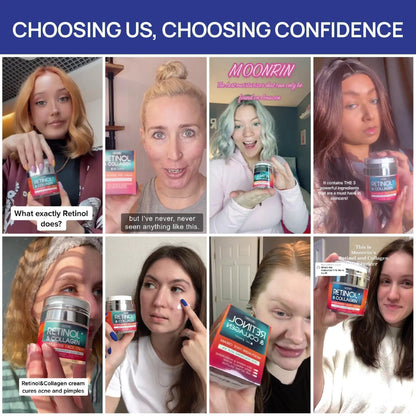 Retinol Cream for Face – Collagen & Hyaluronic Acid Moisturizer