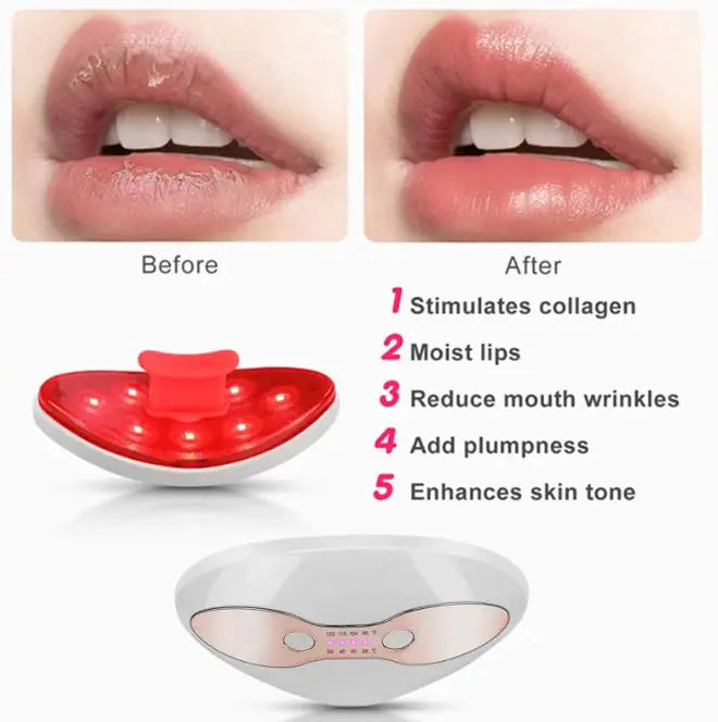 Portable LED Heating Lip Care Device – Hydrating & Soothing Lip Treatment